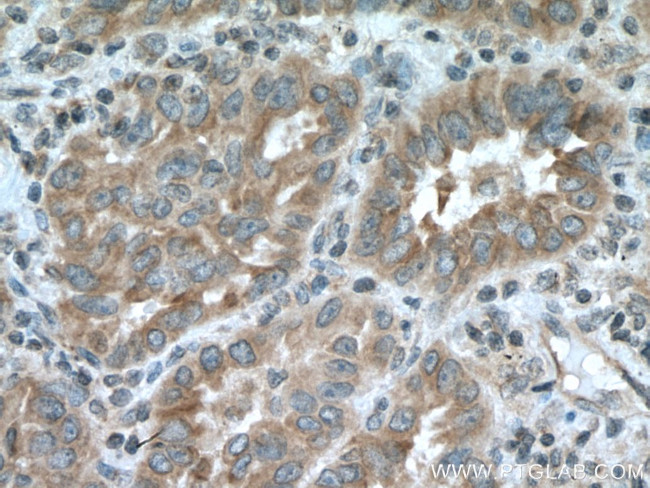 TRIM38 Antibody in Immunohistochemistry (Paraffin) (IHC (P))