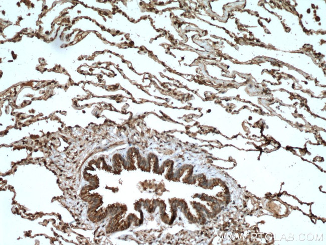 TRIM38 Antibody in Immunohistochemistry (Paraffin) (IHC (P))