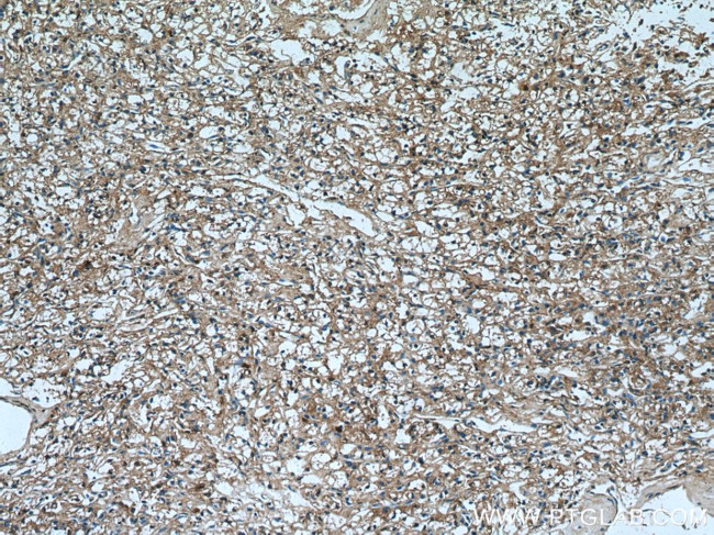 TRIM38 Antibody in Immunohistochemistry (Paraffin) (IHC (P))