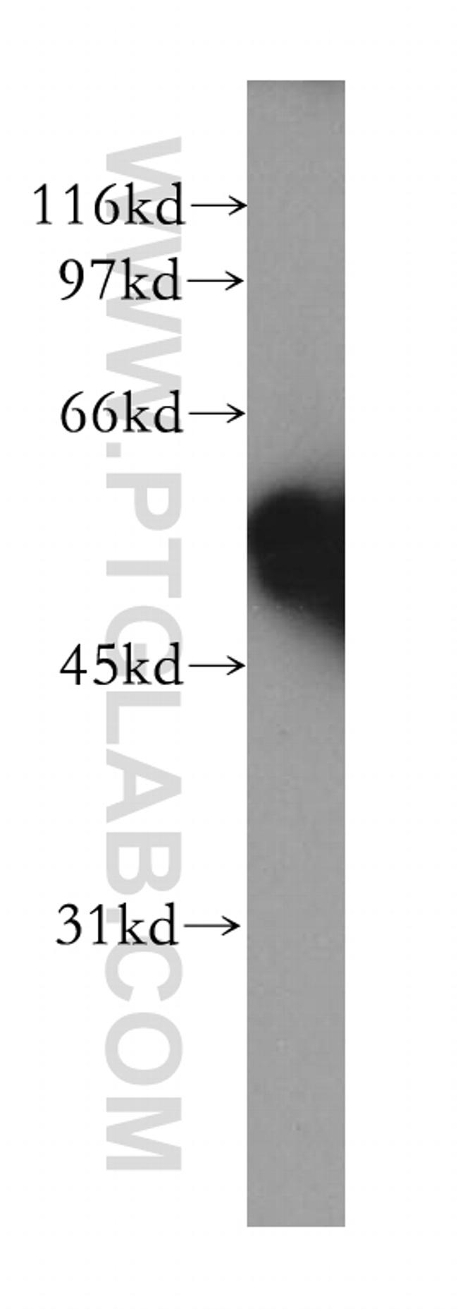 TRIM38 Antibody in Western Blot (WB)