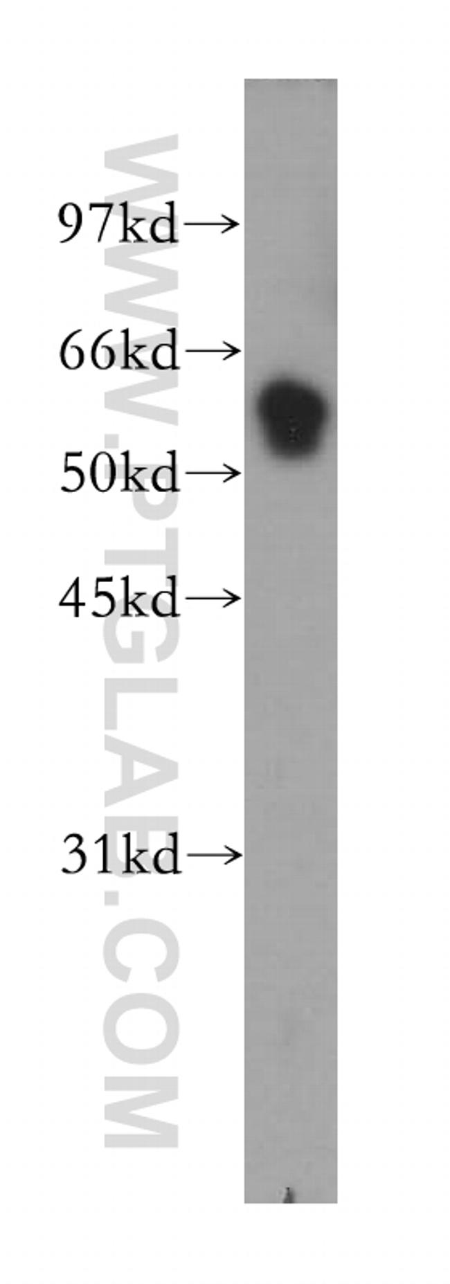 TRIM38 Antibody in Western Blot (WB)