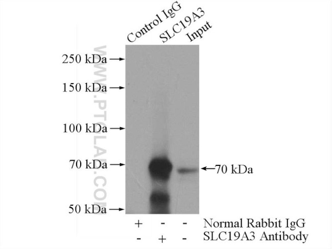 SLC19A3 Antibody in Immunoprecipitation (IP)