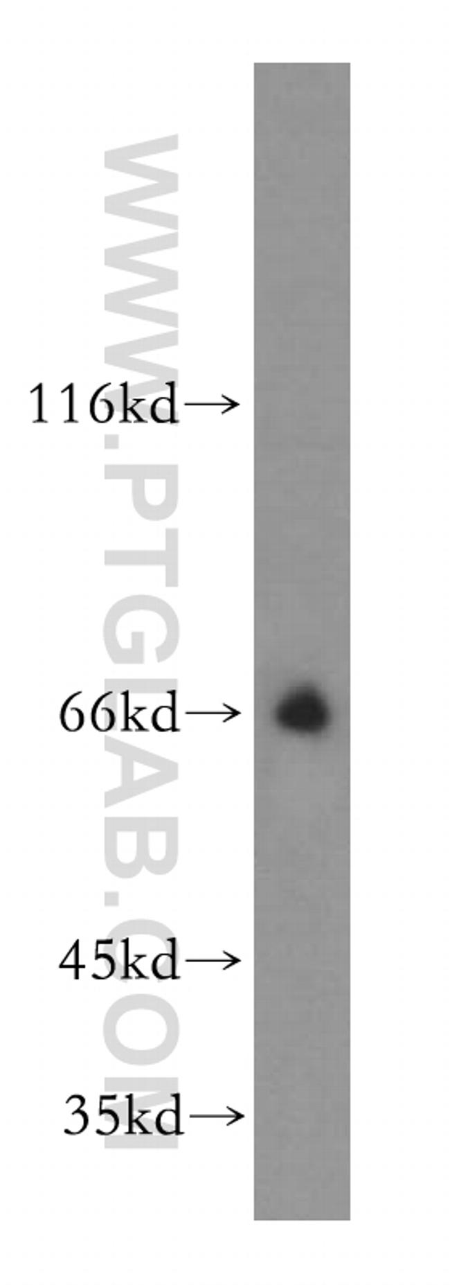 SLC19A3 Antibody in Western Blot (WB)