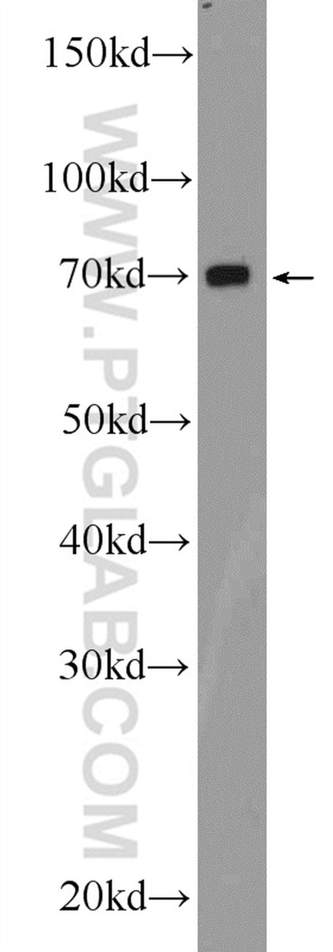 SLC19A3 Antibody in Western Blot (WB)