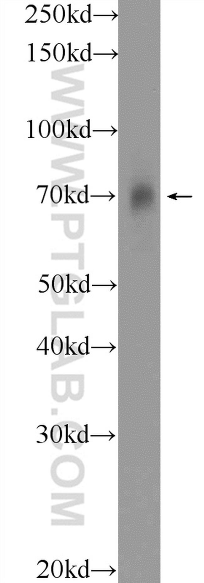 SLC19A3 Antibody in Western Blot (WB)