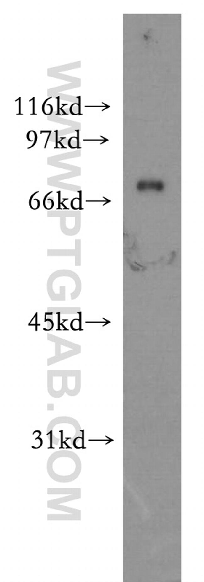 PHACTR4 Antibody in Western Blot (WB)