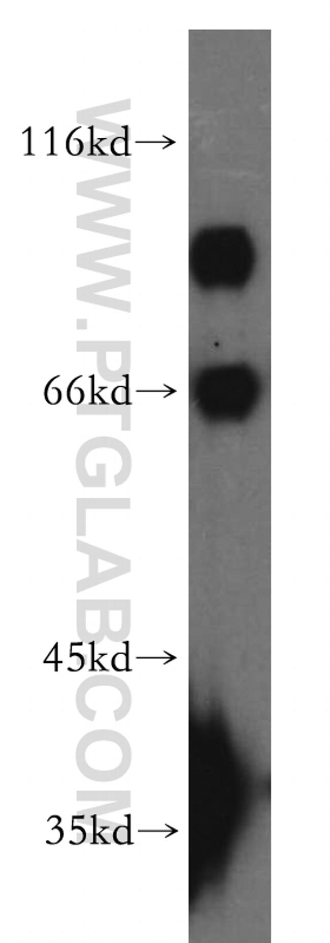 PHACTR4 Antibody in Western Blot (WB)