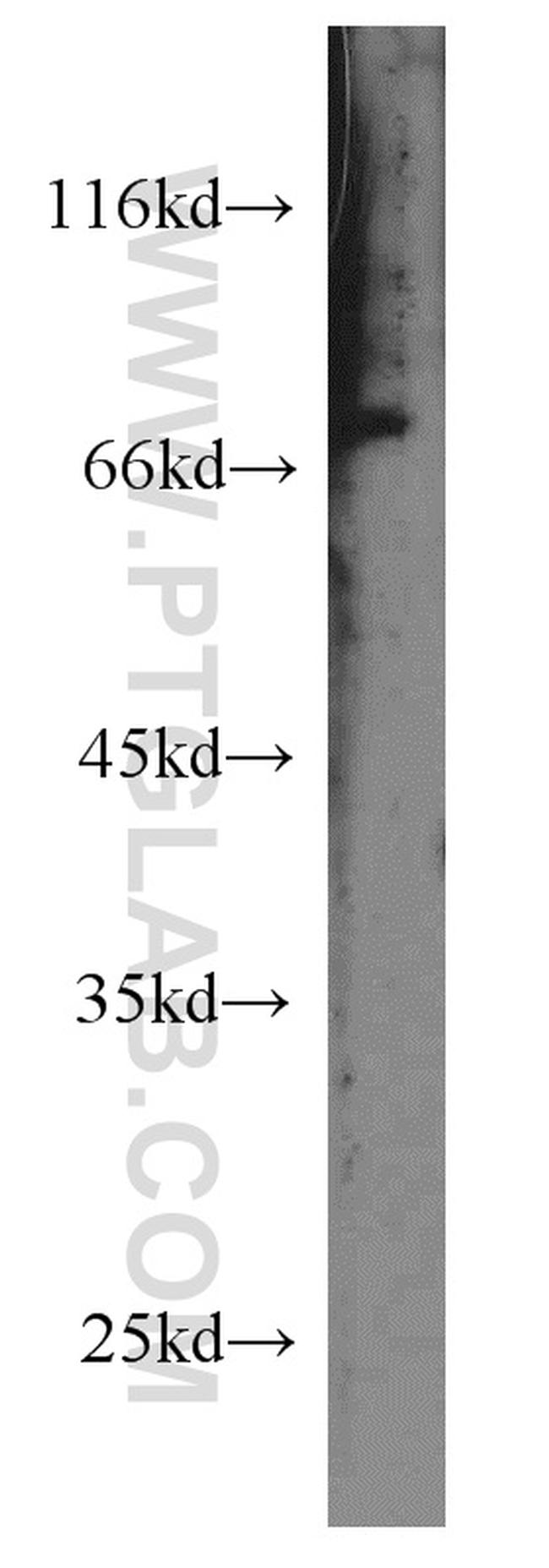 PHACTR4 Antibody in Western Blot (WB)