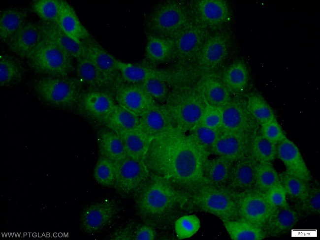 Occludin Antibody in Immunocytochemistry (ICC/IF)