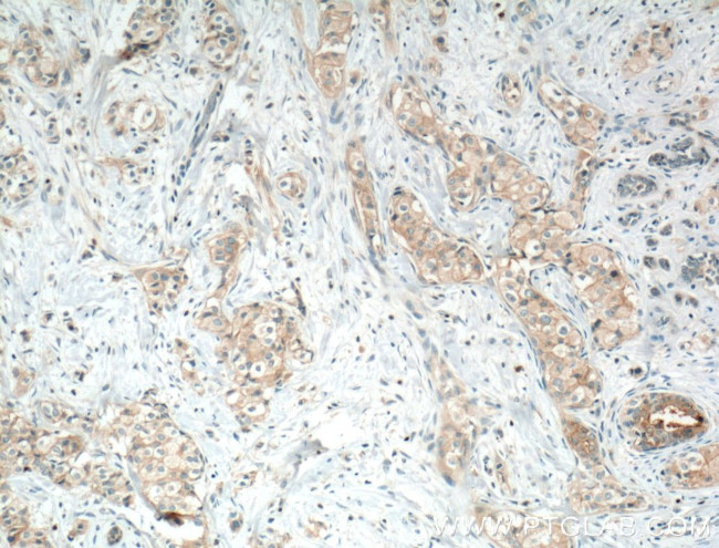 Occludin Antibody in Immunohistochemistry (Paraffin) (IHC (P))