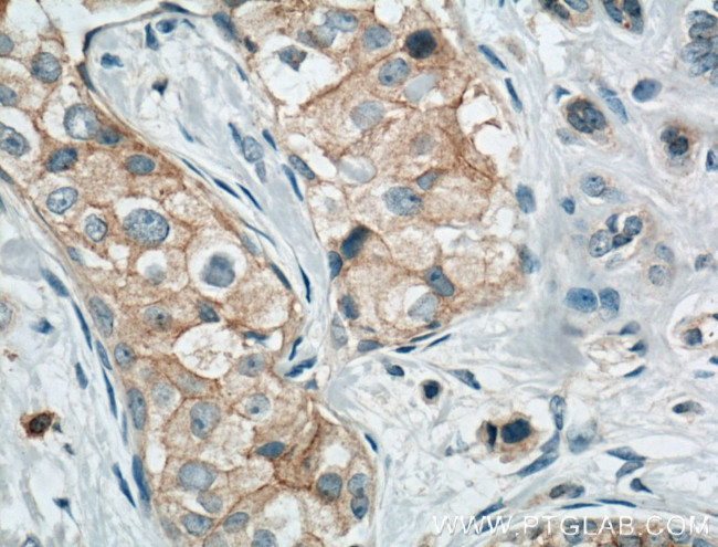 Occludin Antibody in Immunohistochemistry (Paraffin) (IHC (P))