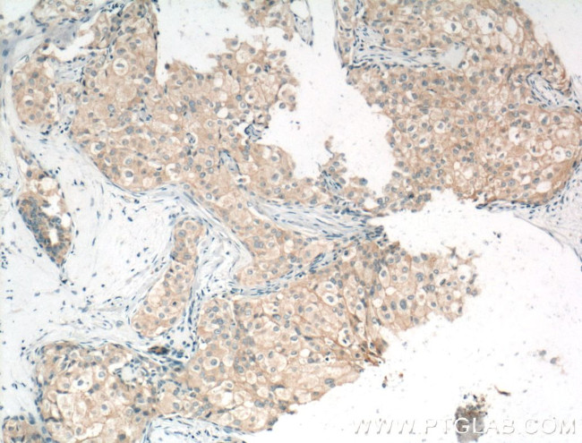 Occludin Antibody in Immunohistochemistry (Paraffin) (IHC (P))