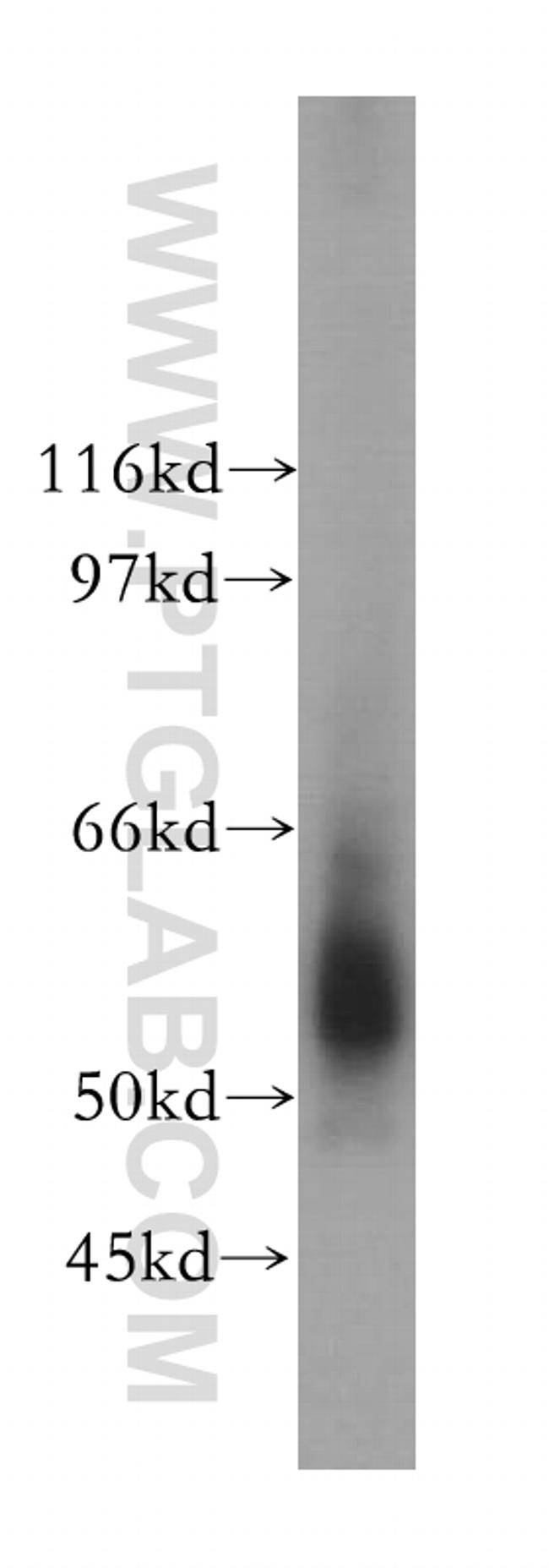 Occludin Antibody in Western Blot (WB)