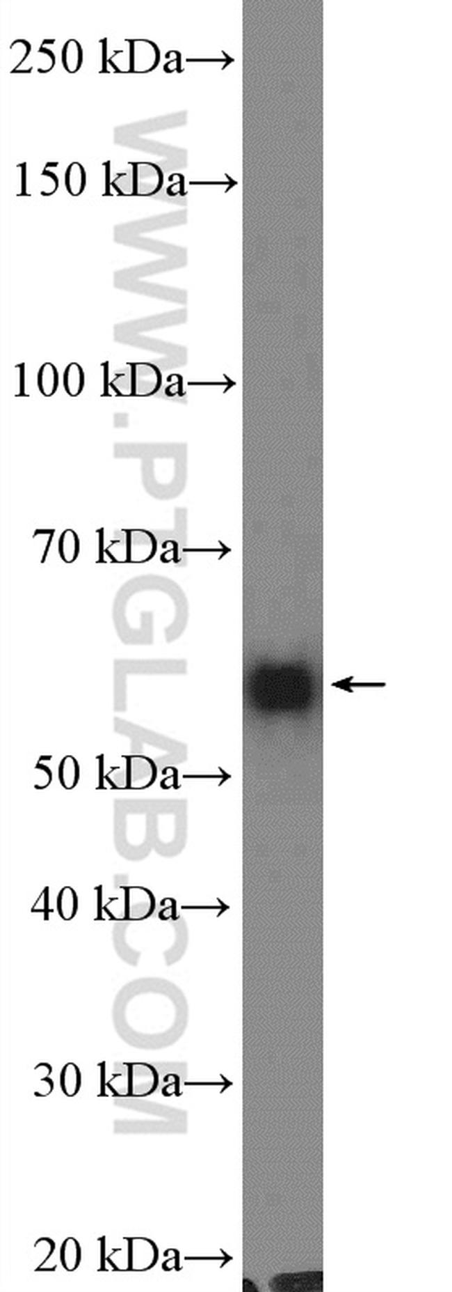 Occludin Antibody in Western Blot (WB)