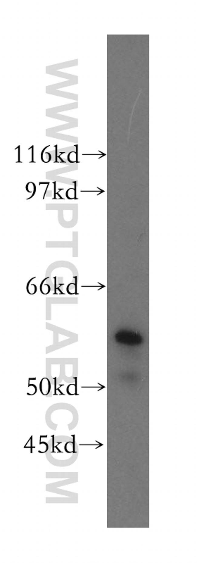 Occludin Antibody in Western Blot (WB)