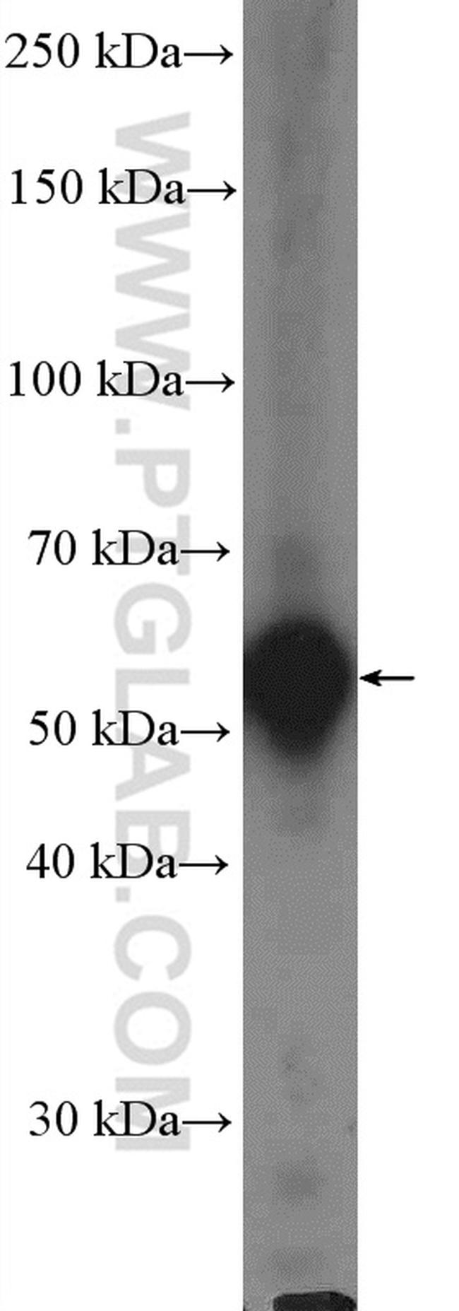 Occludin Antibody in Western Blot (WB)