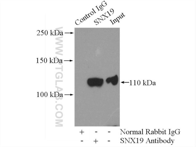 SNX19 Antibody in Immunoprecipitation (IP)