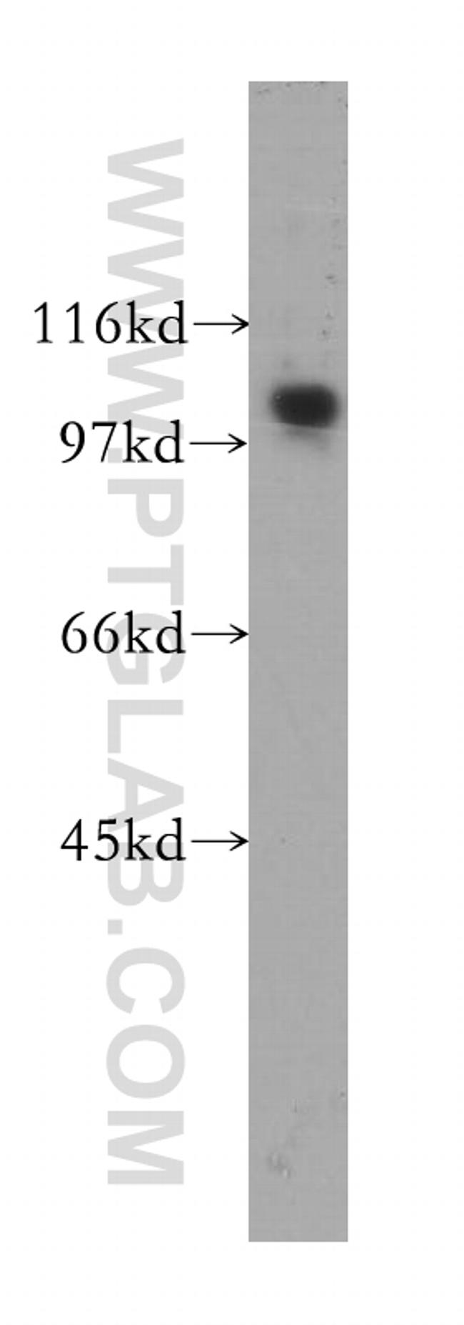 SNX19 Antibody in Western Blot (WB)