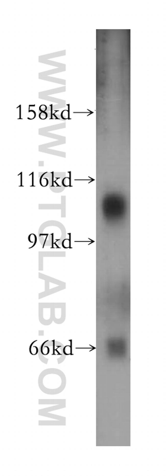 SNX19 Antibody in Western Blot (WB)