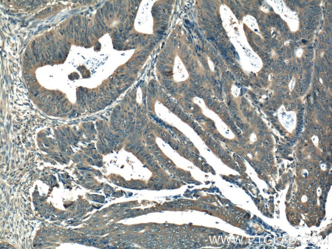 RAB27B Antibody in Immunohistochemistry (Paraffin) (IHC (P))