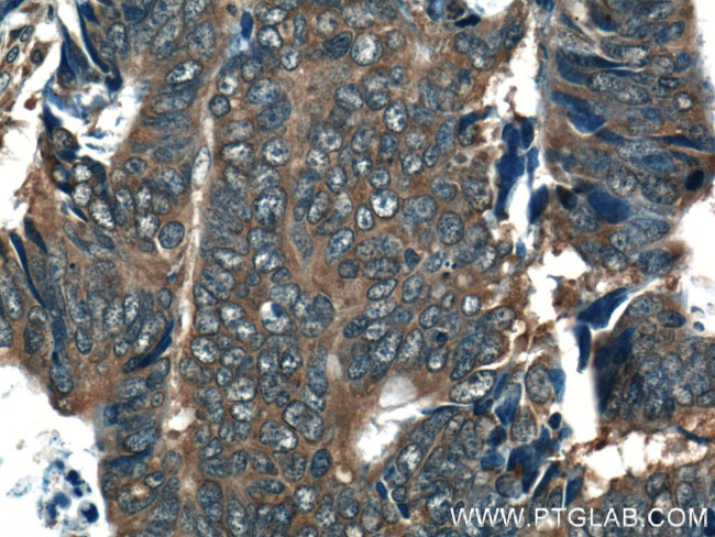 RAB27B Antibody in Immunohistochemistry (Paraffin) (IHC (P))