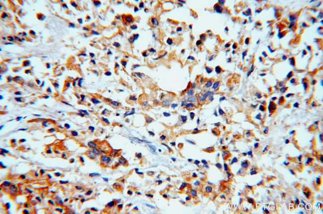 RAB27B Antibody in Immunohistochemistry (Paraffin) (IHC (P))