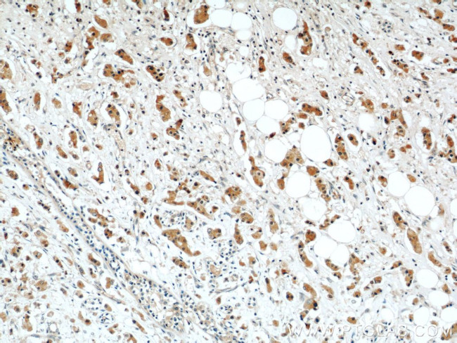 RAB27B Antibody in Immunohistochemistry (Paraffin) (IHC (P))