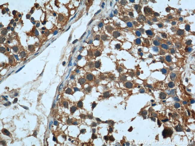 RAB27B Antibody in Immunohistochemistry (Paraffin) (IHC (P))