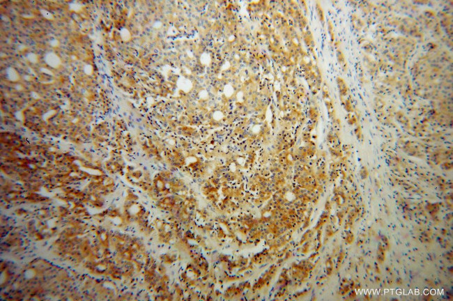 RAB27B Antibody in Immunohistochemistry (Paraffin) (IHC (P))