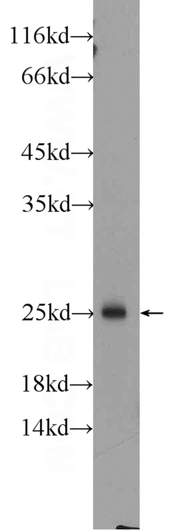 RAB27B Antibody in Western Blot (WB)