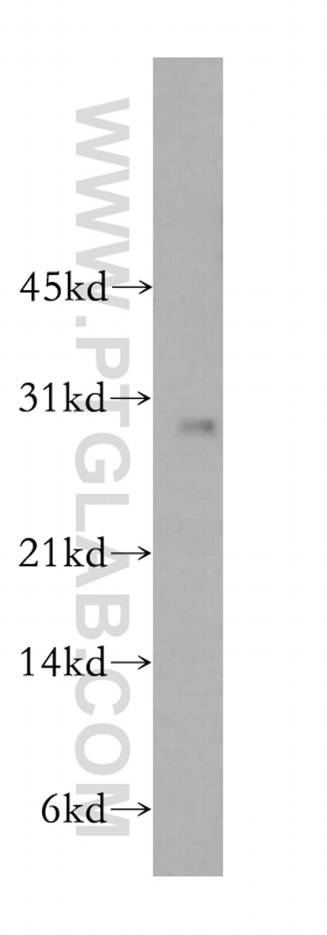 RAB27B Antibody in Western Blot (WB)