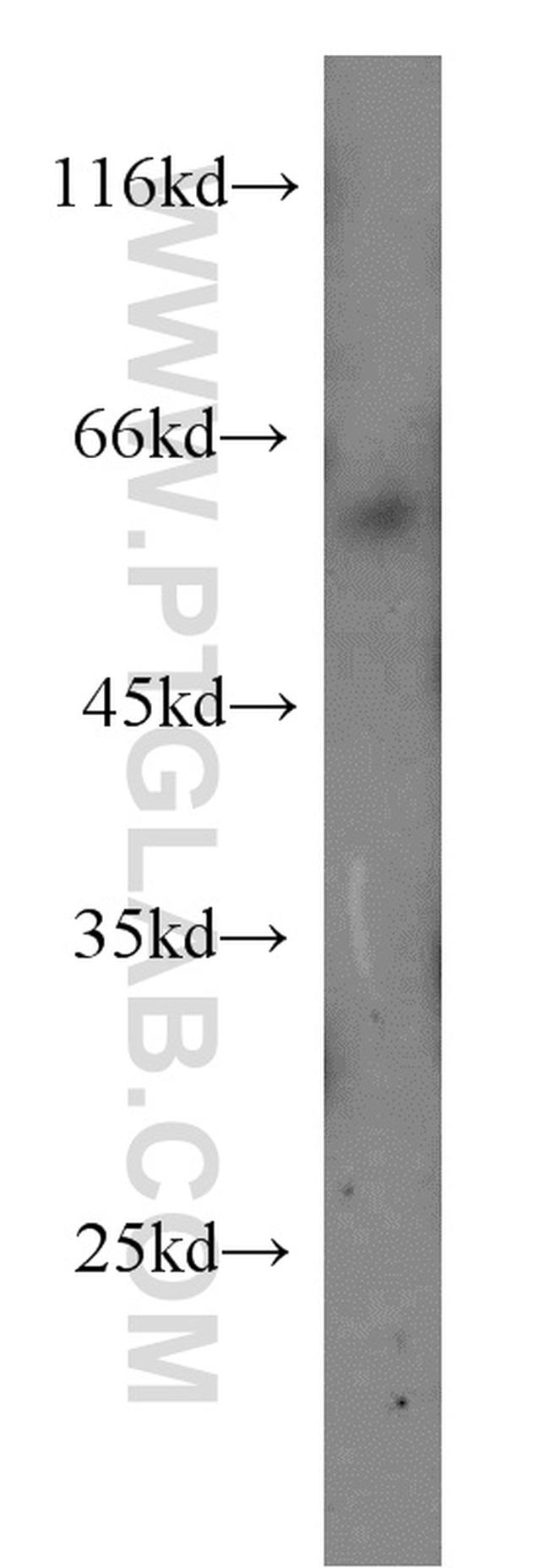 HRH2 Antibody in Western Blot (WB)