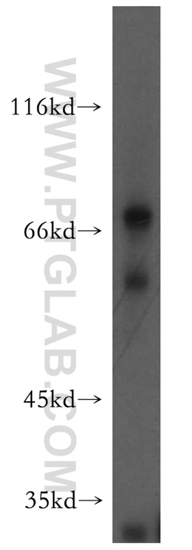 HRH2 Antibody in Western Blot (WB)