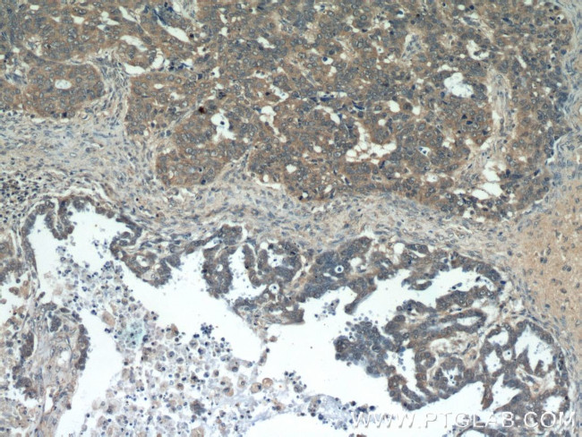 GSK3A Antibody in Immunohistochemistry (Paraffin) (IHC (P))