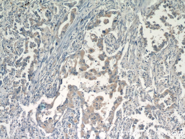 GSK3A Antibody in Immunohistochemistry (Paraffin) (IHC (P))