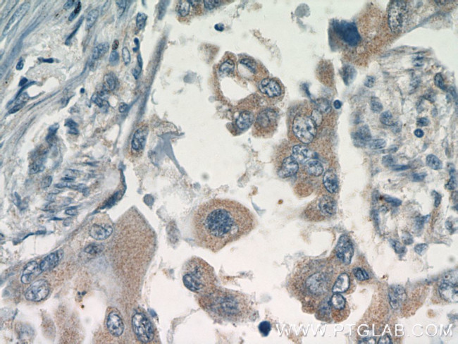 GSK3A Antibody in Immunohistochemistry (Paraffin) (IHC (P))