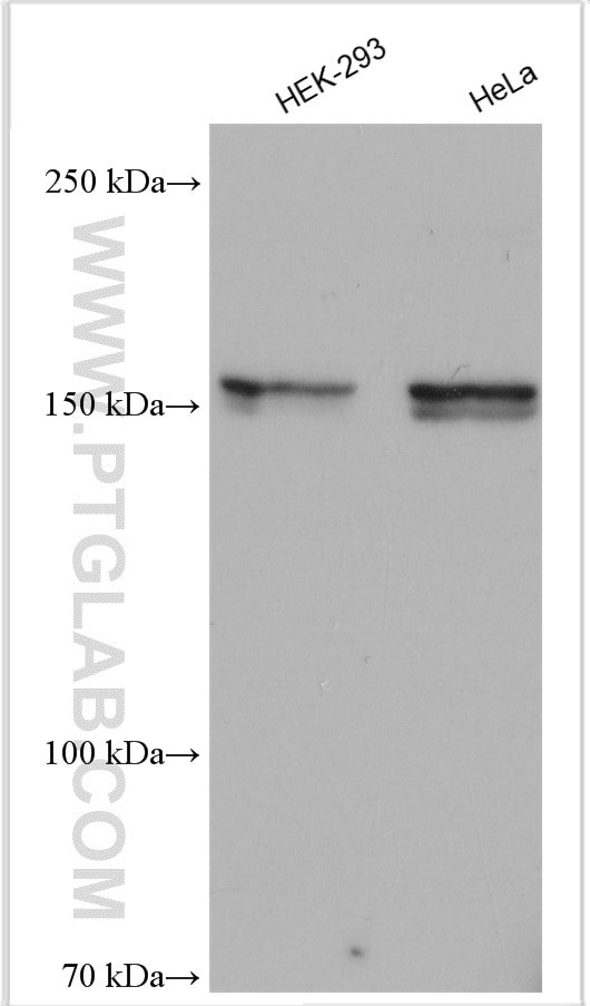 UGCGL2 Antibody in Western Blot (WB)