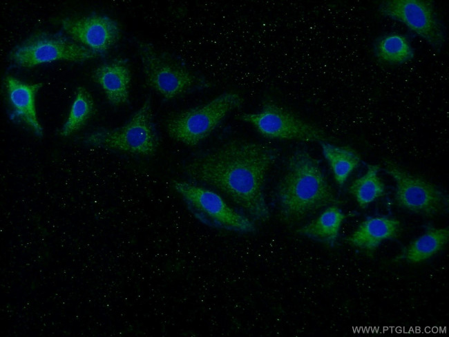 PPP3CA Antibody in Immunocytochemistry (ICC/IF)