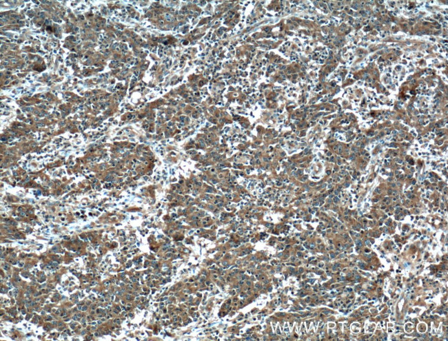 PPP3CA Antibody in Immunohistochemistry (Paraffin) (IHC (P))