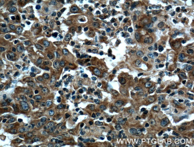 PPP3CA Antibody in Immunohistochemistry (Paraffin) (IHC (P))