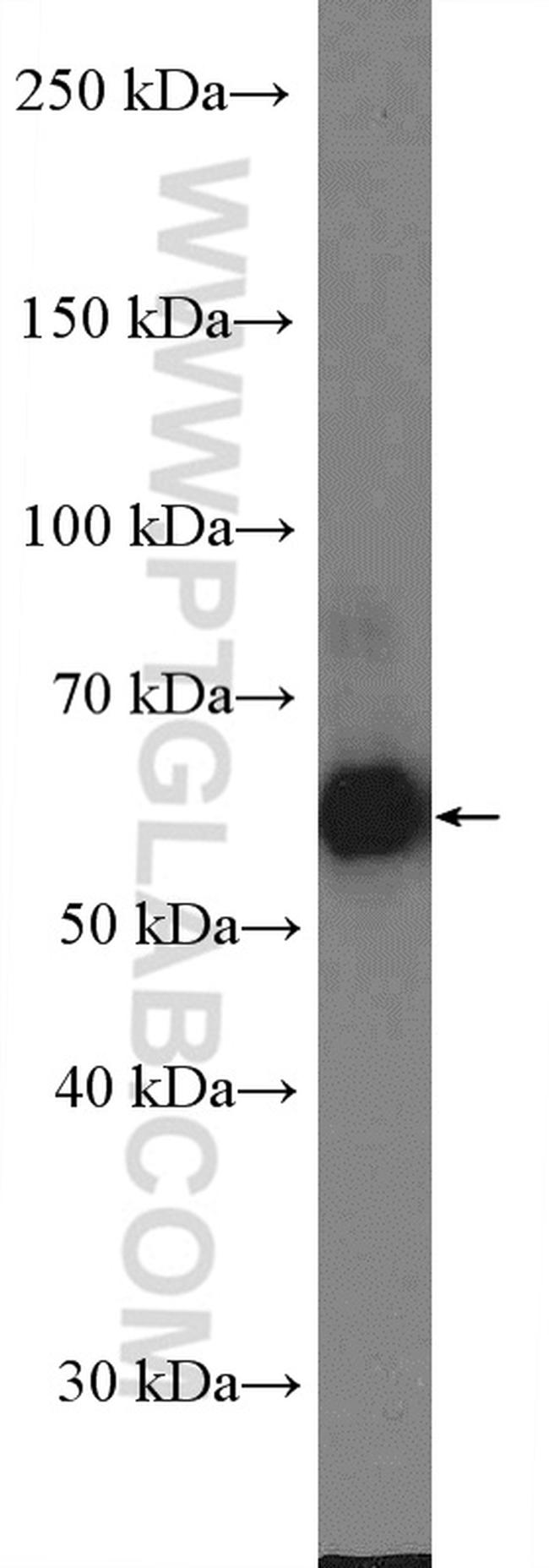 PPP3CA Antibody in Western Blot (WB)