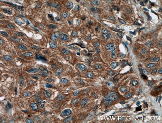 PPP3CA Antibody in Immunohistochemistry (Paraffin) (IHC (P))