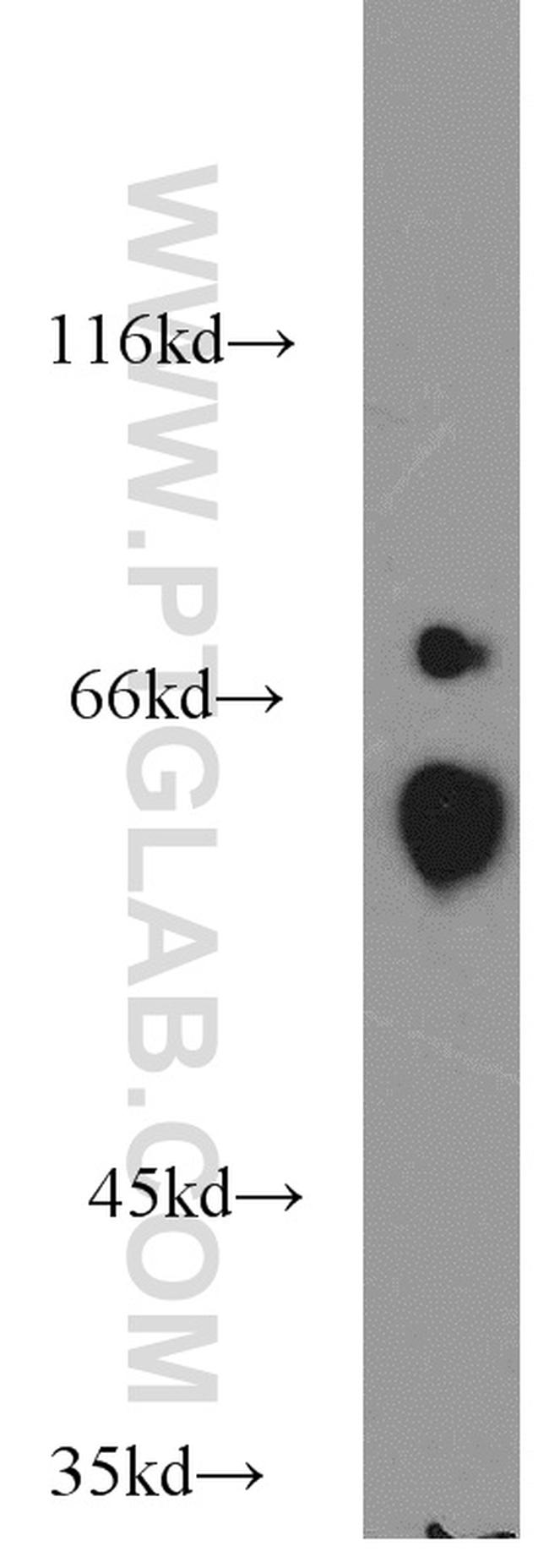 PPP3CA Antibody in Western Blot (WB)