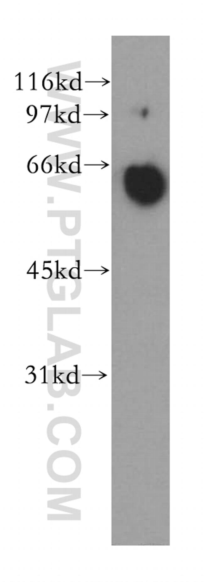 PPP3CA Antibody in Western Blot (WB)