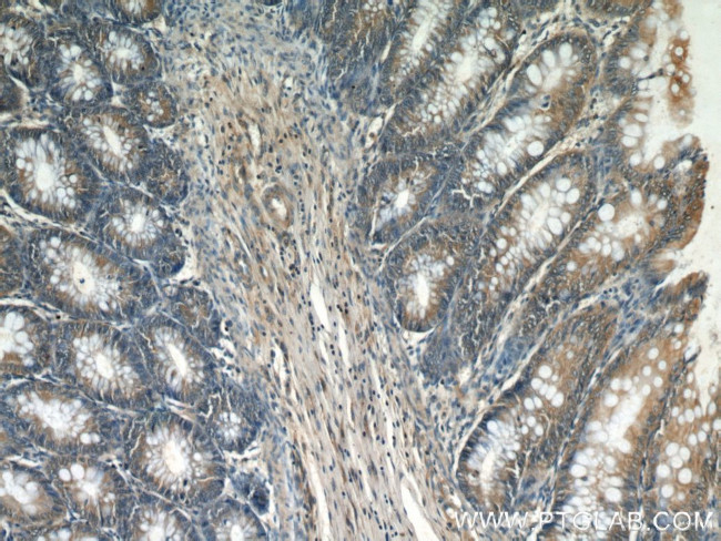 Caspase 8 Antibody in Immunohistochemistry (Paraffin) (IHC (P))