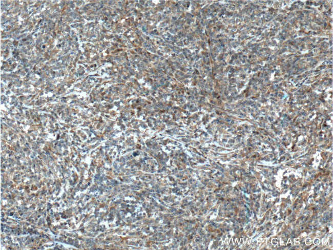 Caspase 8 Antibody in Immunohistochemistry (Paraffin) (IHC (P))