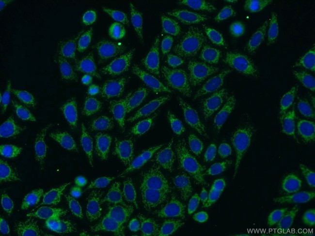 DLAT Antibody in Immunocytochemistry (ICC/IF)