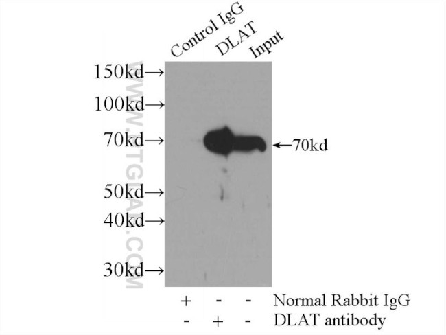 DLAT Antibody in Immunoprecipitation (IP)