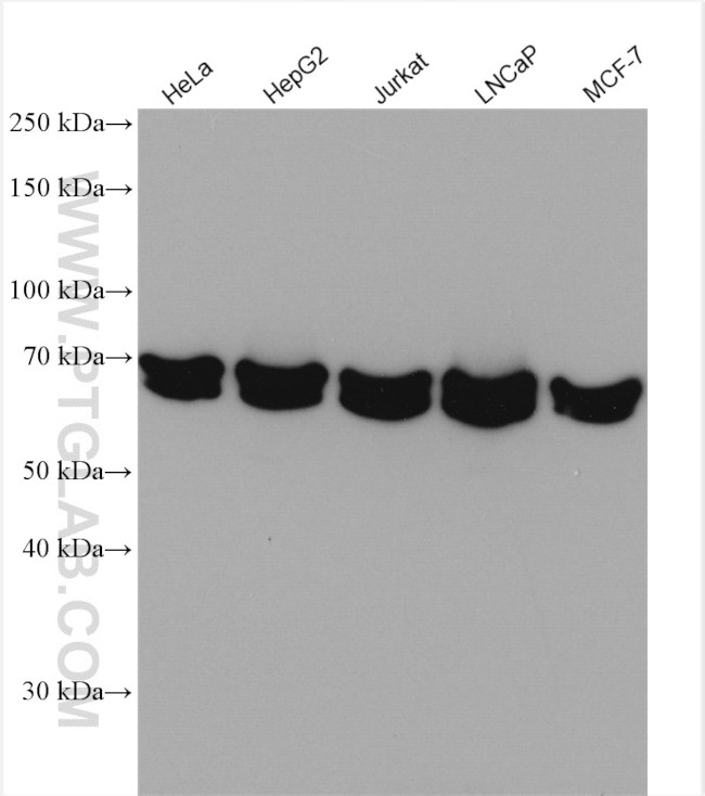 DLAT Antibody in Western Blot (WB)