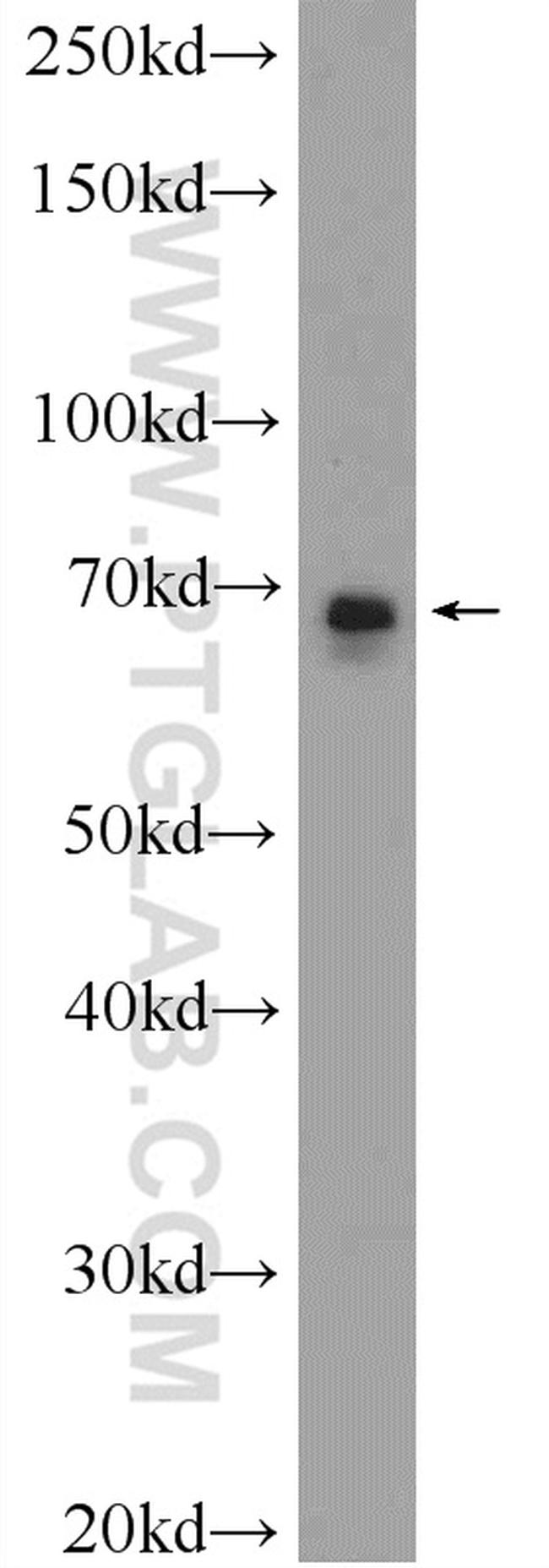 DLAT Antibody in Western Blot (WB)